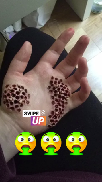 Trypophobia: 15 Pics That Will Make You Cry in Fear