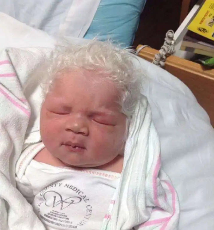 When The Baby Is Born With Snow-White Hair, The Parents Are Unsure Of What To Do…